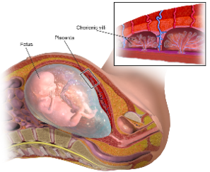 Chorionic villus sampling (CVS)